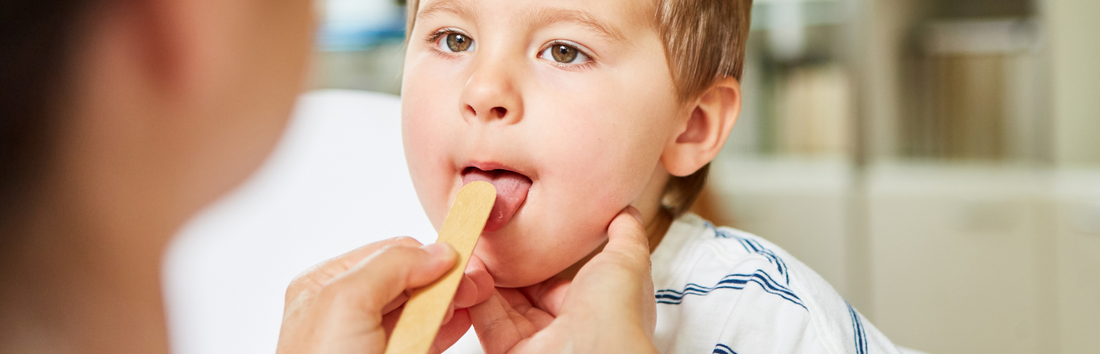 Streptokokken – Ursachen, Symptome und Behandlung der Infektion