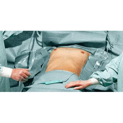 Hartmann Fdrape PP Juego cardiovascular P3 | Paquete (3 piezas)
